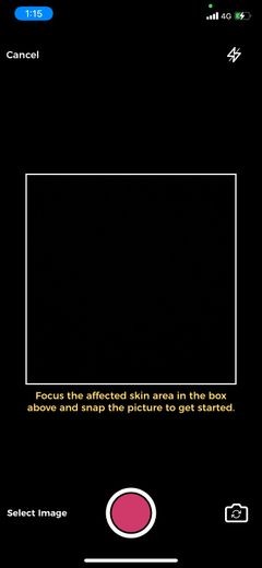Tìm thấy một dấu hiệu kỳ lạ trên da của bạn? Dưới đây là 5 ứng dụng da liễu tốt nhất để chẩn đoán bệnh 