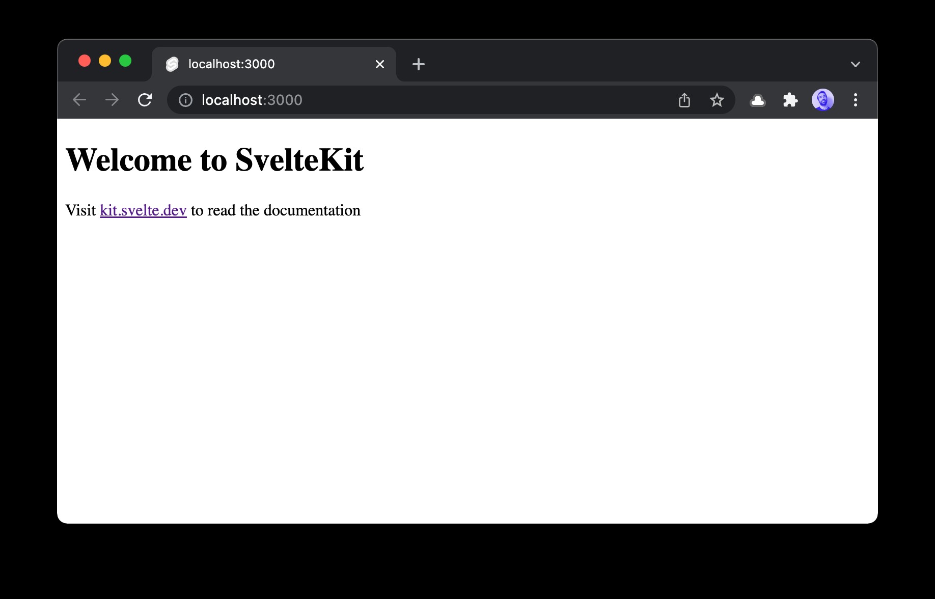 Ứng dụng SvelteKit TODO với Redis 